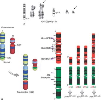 qPCR workflow detecting BCR-ABL1 fusion gene variants in blood or marrow