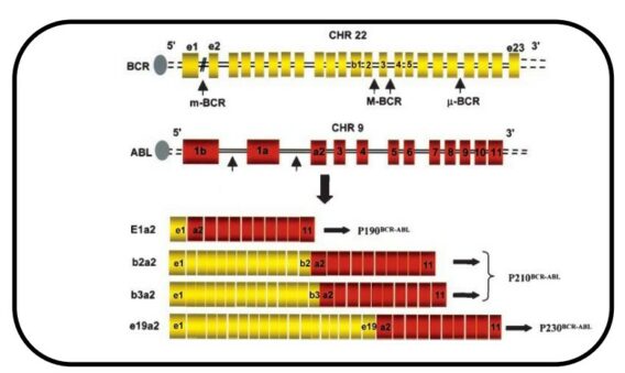 RUPCR BCR-ABL1 qPCR detection kit for identifying BCR-ABL1 fusion gene transcripts in leukemia diagnostics