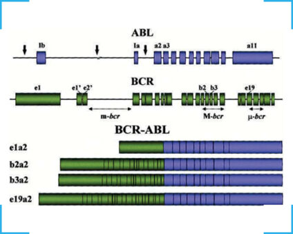 BCR-ABL Quantification Kit workflow – TRUPCR RT-qPCR for leukemia diagnostics